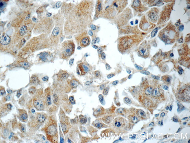 RB1CC1 Antibody in Immunohistochemistry (Paraffin) (IHC (P))