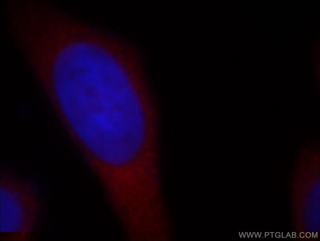 RB1CC1 Antibody in Immunocytochemistry (ICC/IF)