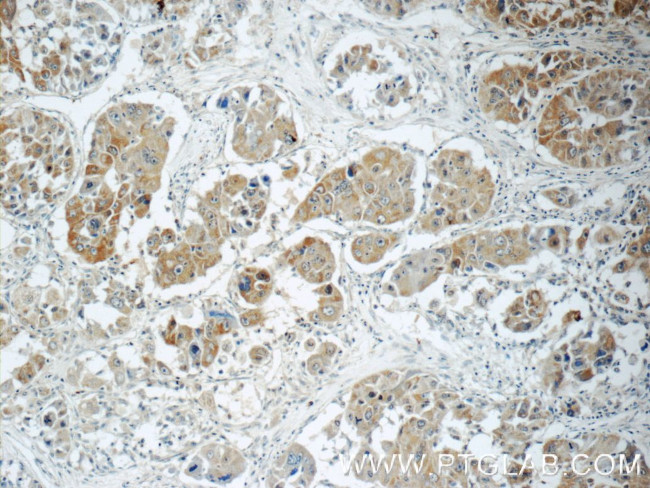 RB1CC1 Antibody in Immunohistochemistry (Paraffin) (IHC (P))