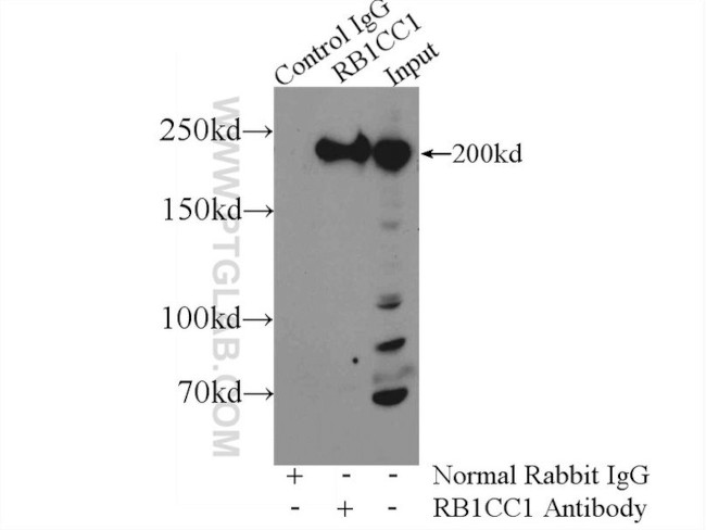 RB1CC1 Antibody in Immunoprecipitation (IP)