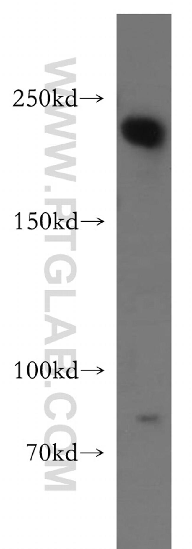 RB1CC1 Antibody in Western Blot (WB)