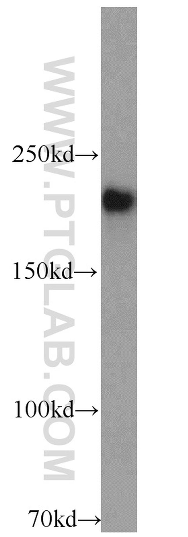 RB1CC1 Antibody in Western Blot (WB)