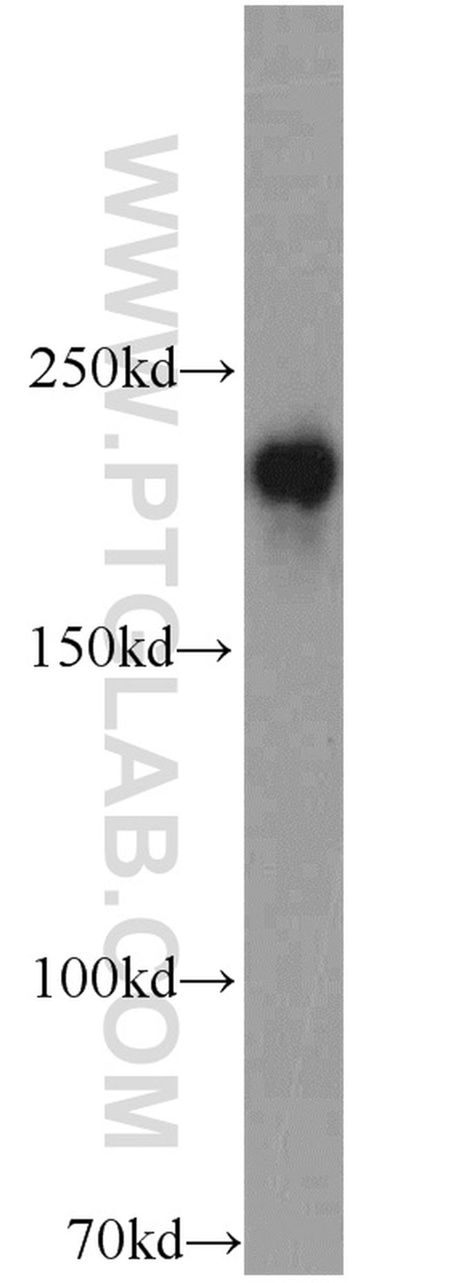 RB1CC1 Antibody in Western Blot (WB)