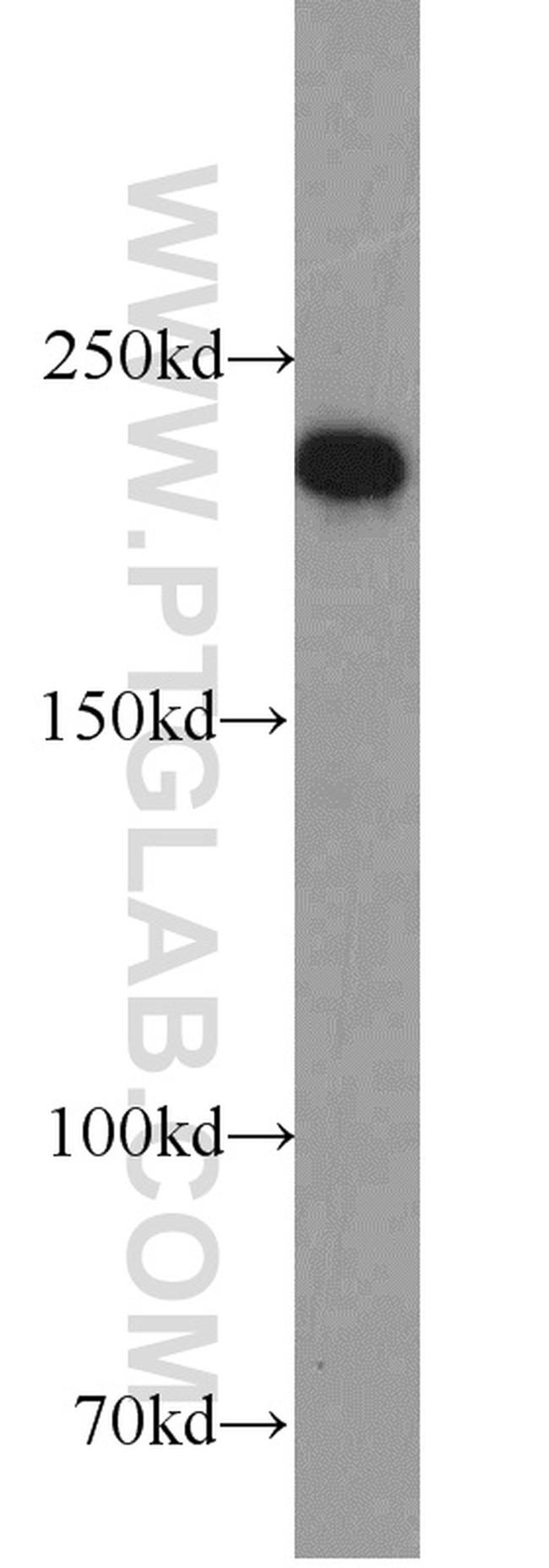 RB1CC1 Antibody in Western Blot (WB)