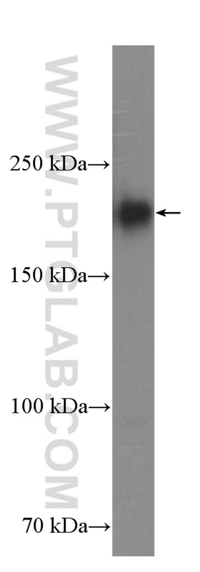 RB1CC1 Antibody in Western Blot (WB)