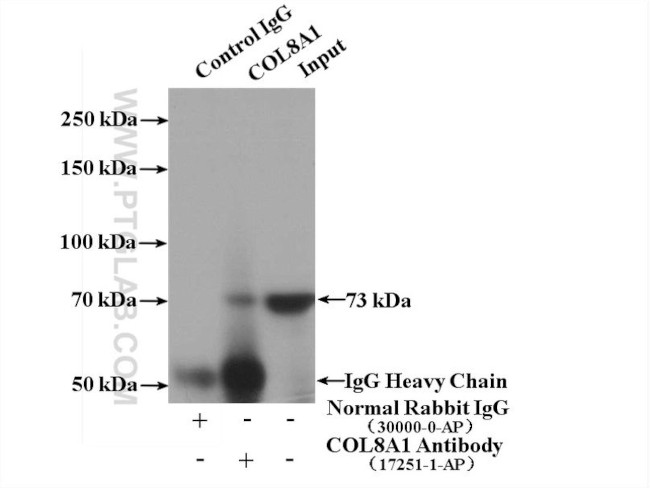 Collagen Type VIII Antibody in Immunoprecipitation (IP)