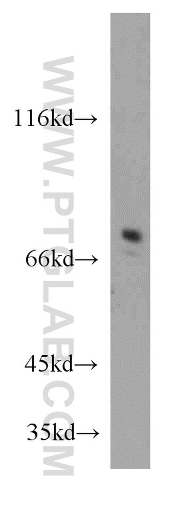 Collagen Type VIII Antibody in Western Blot (WB)