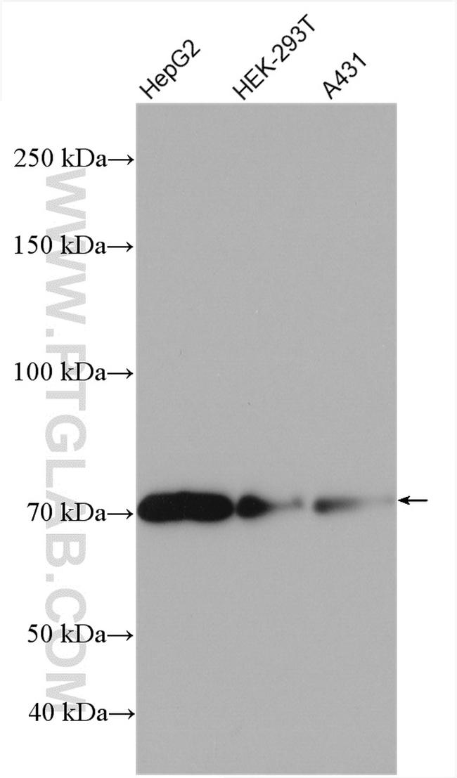 TBC1D15 Antibody in Western Blot (WB)