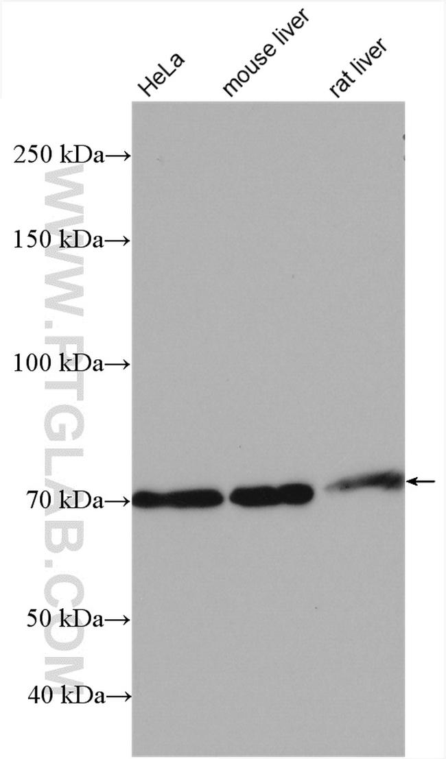 TBC1D15 Antibody in Western Blot (WB)