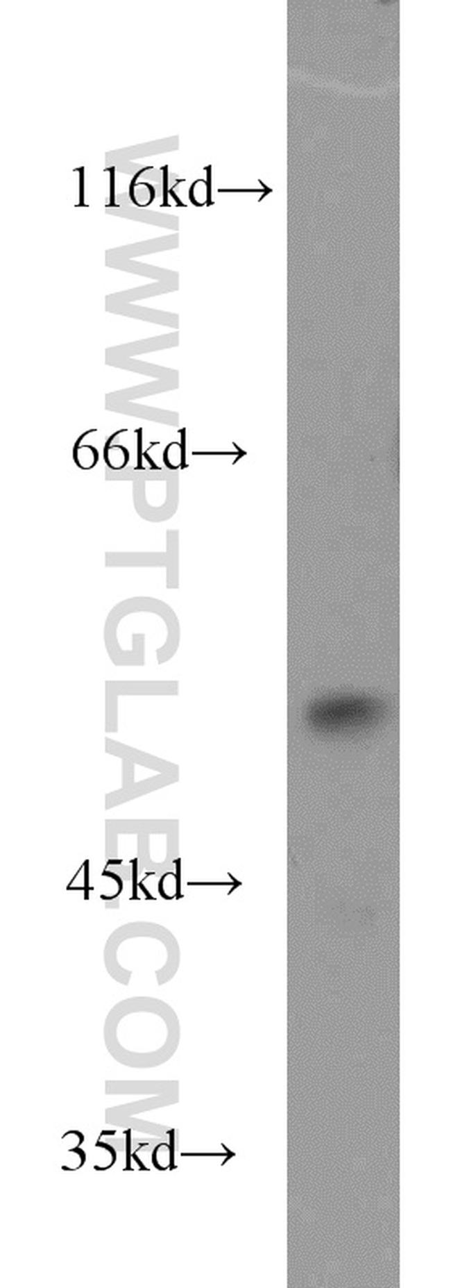 DUS1L Antibody in Western Blot (WB)