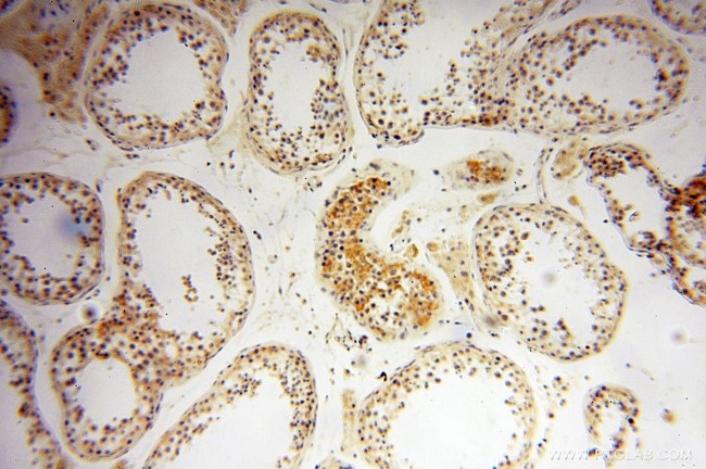 SQRDL Antibody in Immunohistochemistry (Paraffin) (IHC (P))