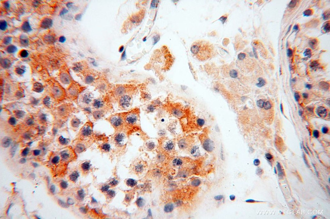 SQRDL Antibody in Immunohistochemistry (Paraffin) (IHC (P))