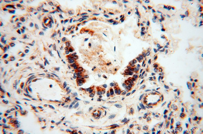 SQRDL Antibody in Immunohistochemistry (Paraffin) (IHC (P))