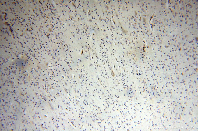 SQRDL Antibody in Immunohistochemistry (Paraffin) (IHC (P))