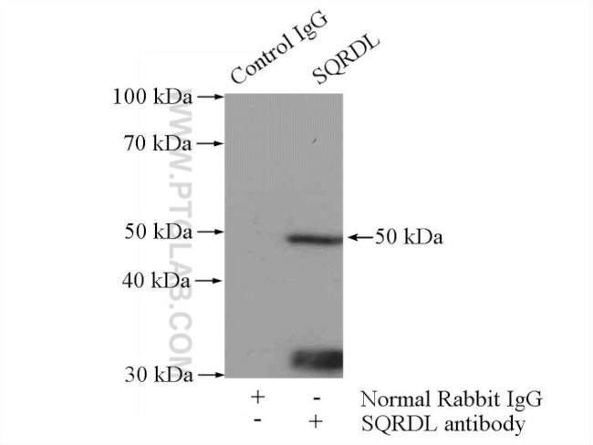 SQRDL Antibody in Immunoprecipitation (IP)