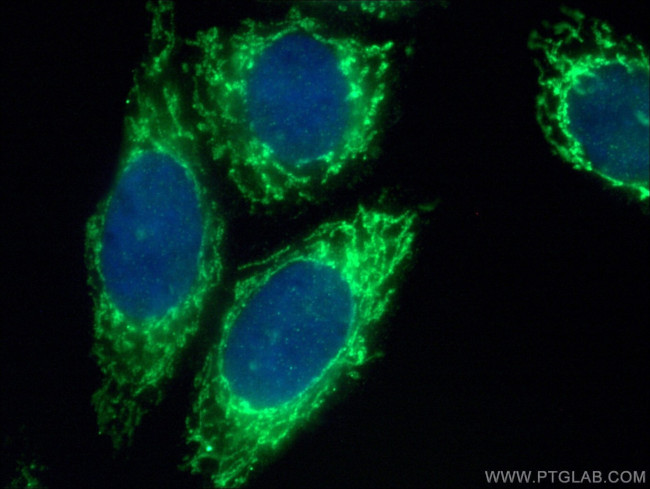 SARS2 Antibody in Immunocytochemistry (ICC/IF)