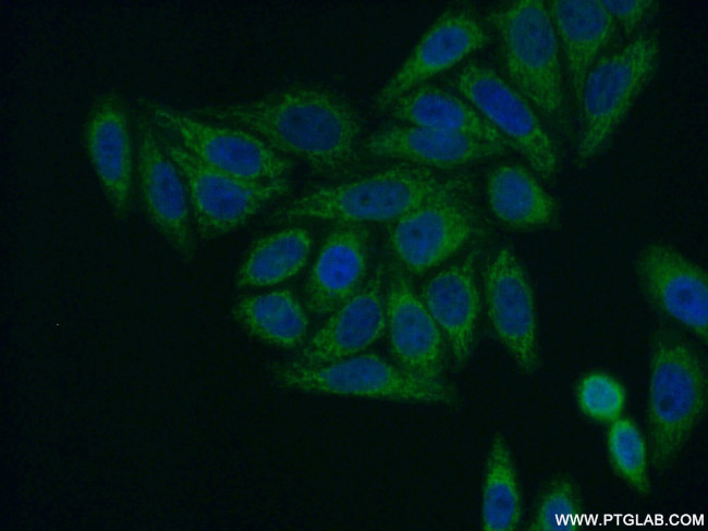 SARS2 Antibody in Immunocytochemistry (ICC/IF)