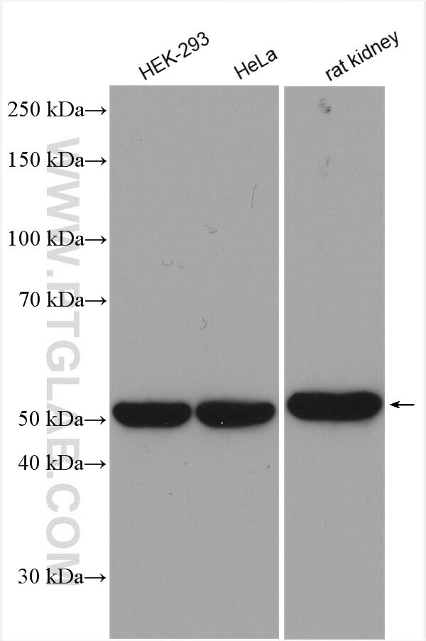 SARS2 Antibody in Western Blot (WB)