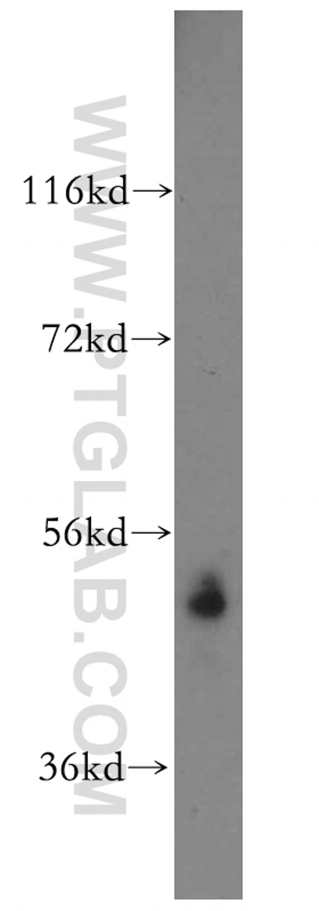 SARS2 Antibody in Western Blot (WB)