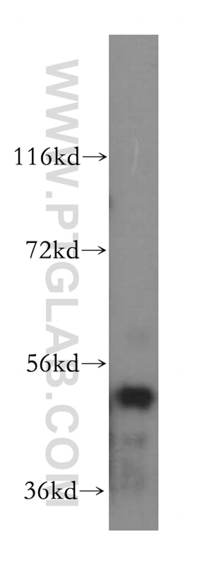 SARS2 Antibody in Western Blot (WB)