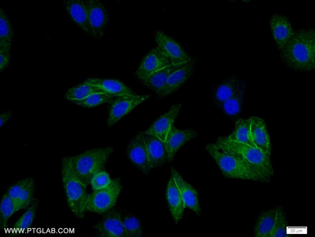 HLA class I (HLA-B) Antibody in Immunocytochemistry (ICC/IF)