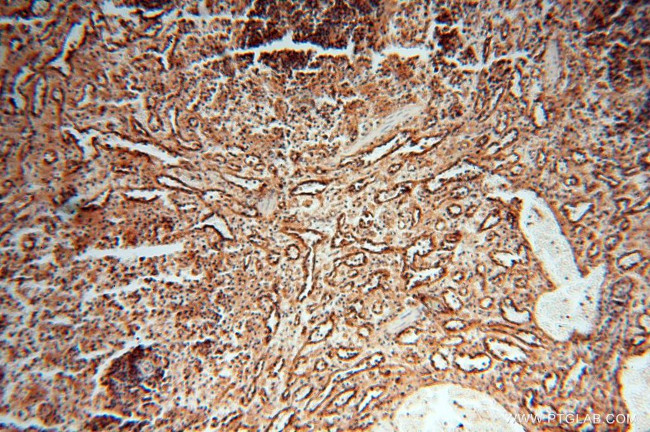 HLA class I (HLA-B) Antibody in Immunohistochemistry (Paraffin) (IHC (P))