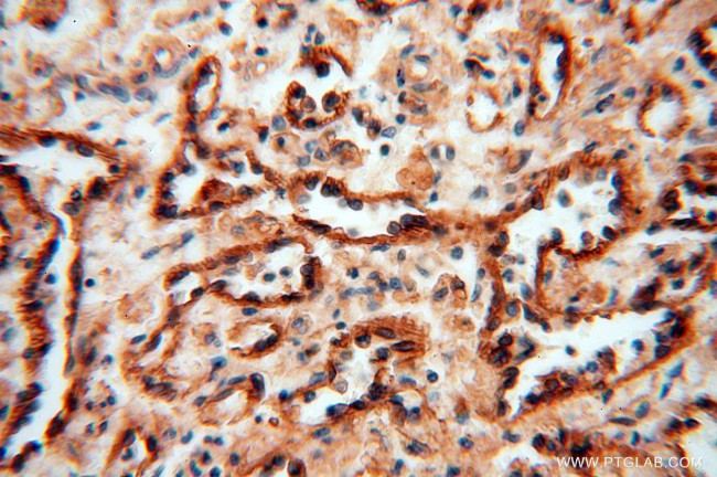 HLA class I (HLA-B) Antibody in Immunohistochemistry (Paraffin) (IHC (P))