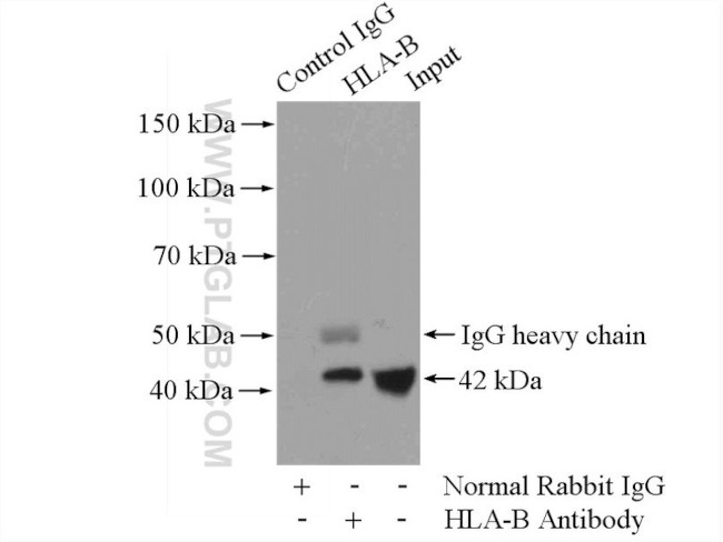 HLA class I (HLA-B) Antibody in Immunoprecipitation (IP)