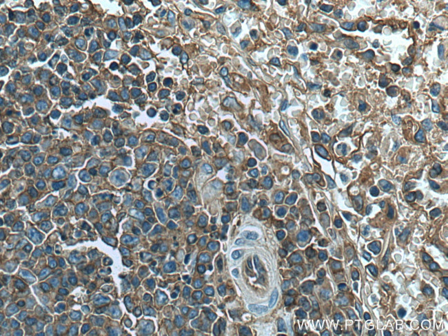 HLA class I (HLA-B) Antibody in Immunohistochemistry (Paraffin) (IHC (P))