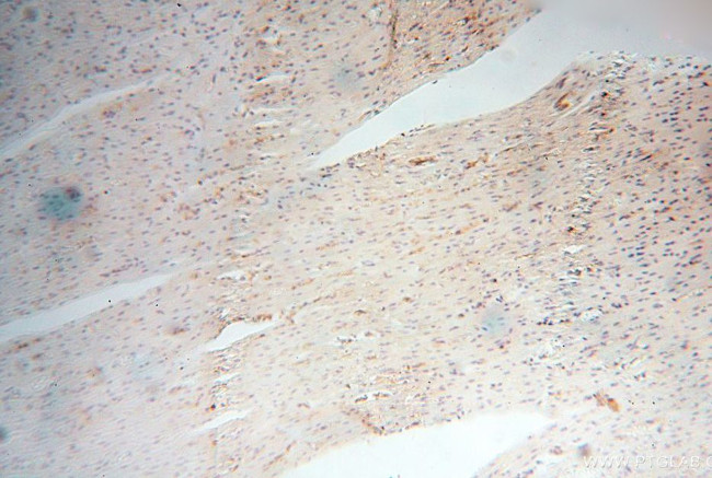 HLA class I (HLA-B) Antibody in Immunohistochemistry (Paraffin) (IHC (P))