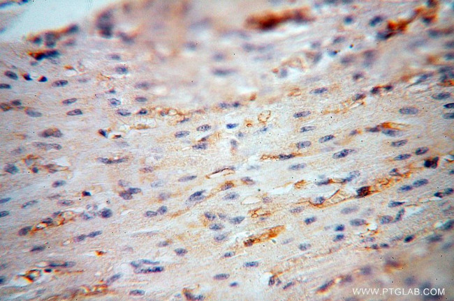 HLA class I (HLA-B) Antibody in Immunohistochemistry (Paraffin) (IHC (P))