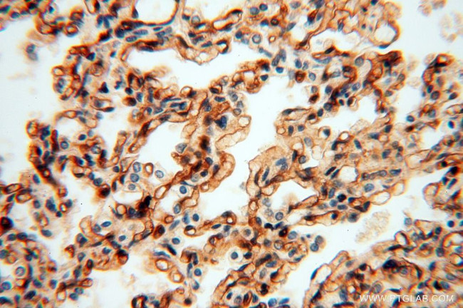 HLA class I (HLA-B) Antibody in Immunohistochemistry (Paraffin) (IHC (P))