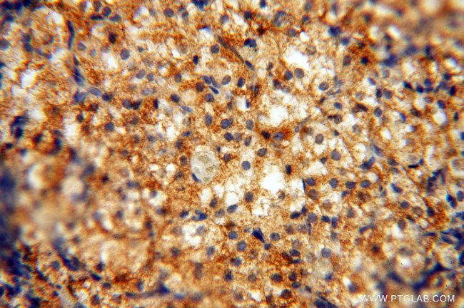 HLA class I (HLA-B) Antibody in Immunohistochemistry (Paraffin) (IHC (P))