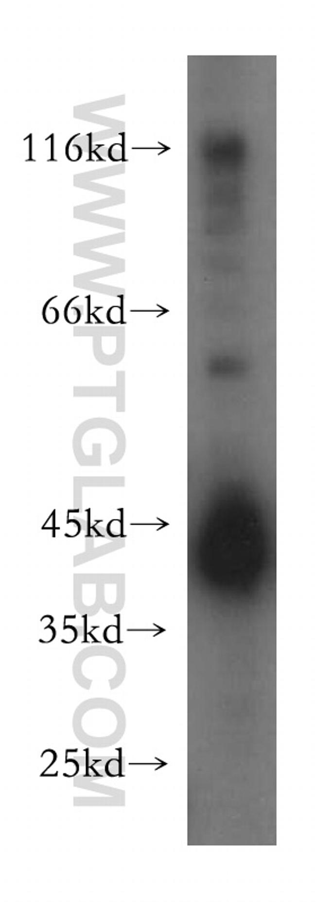 HLA class I (HLA-B) Antibody in Western Blot (WB)