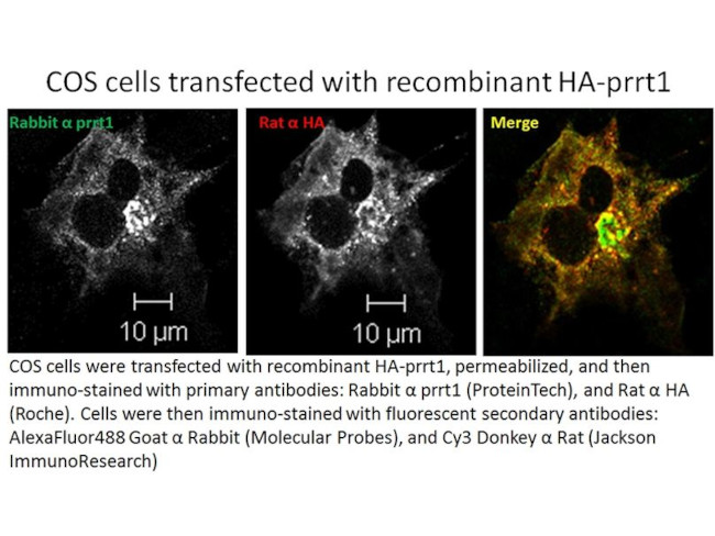 SynDIG4/PRRT1 Antibody in Immunocytochemistry (ICC/IF)