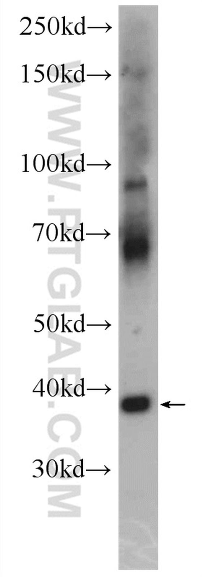 SynDIG4/PRRT1 Antibody in Western Blot (WB)