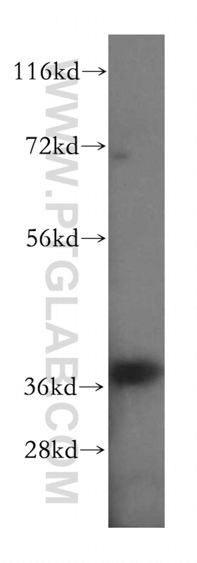 GPD1L Antibody in Western Blot (WB)