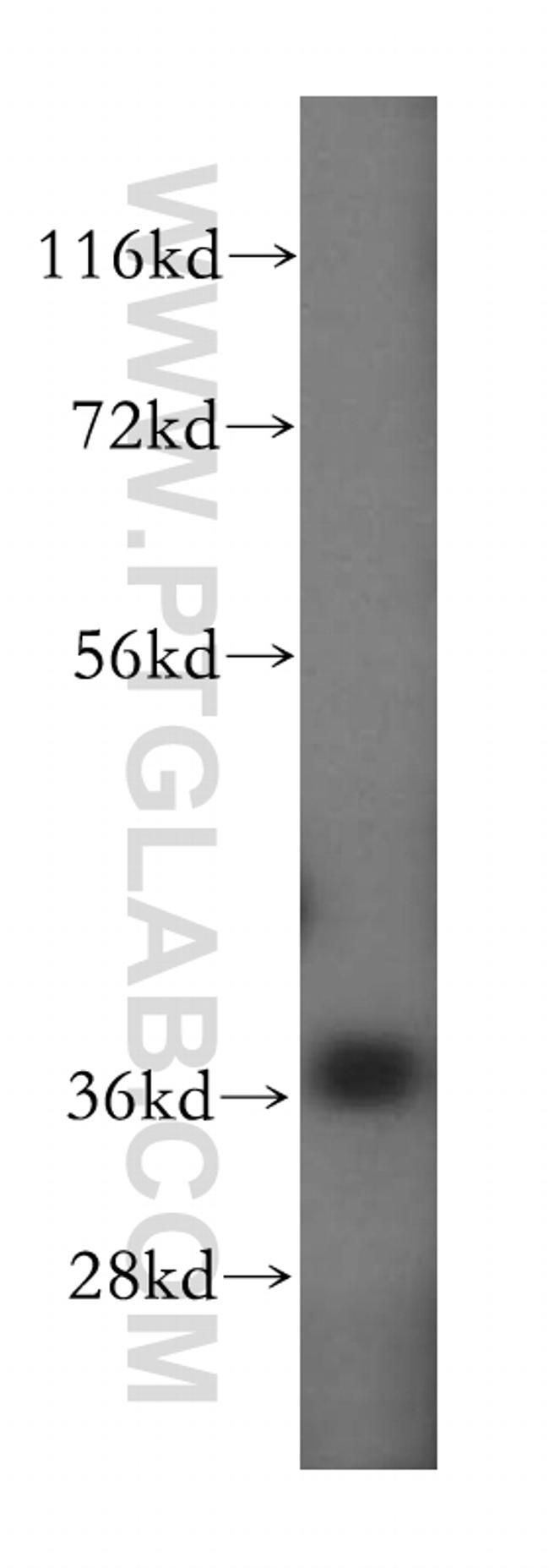 GPD1L Antibody in Western Blot (WB)