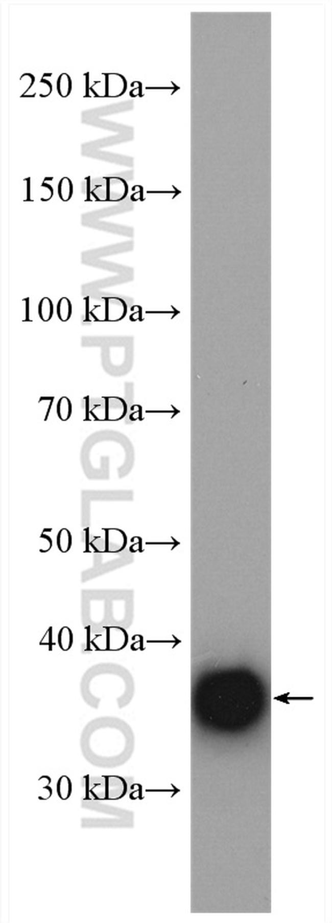 GPD1L Antibody in Western Blot (WB)