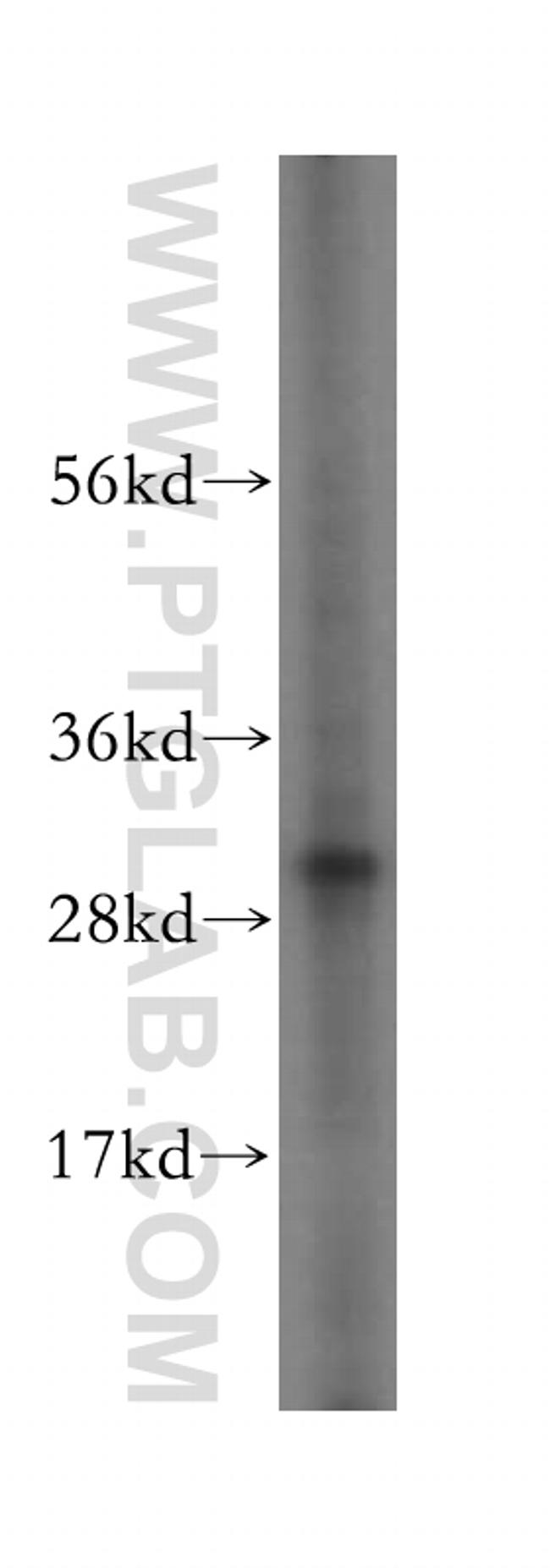 MITD1 Antibody in Western Blot (WB)