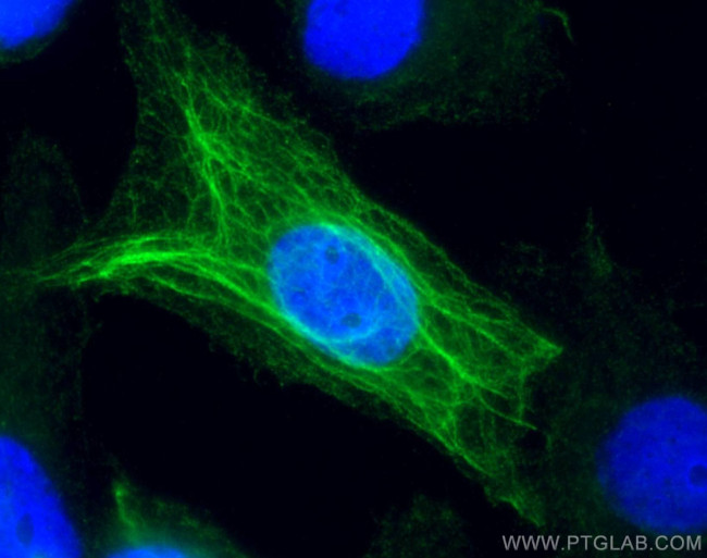 Cytokeratin 16 Antibody in Immunocytochemistry (ICC/IF)