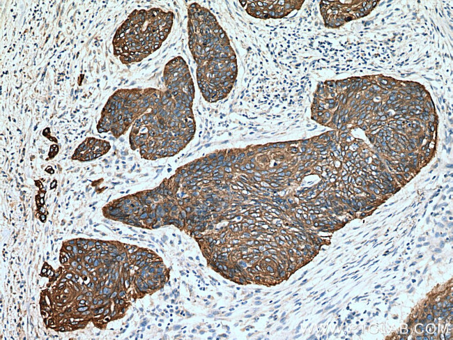 Cytokeratin 16 Antibody in Immunohistochemistry (Paraffin) (IHC (P))