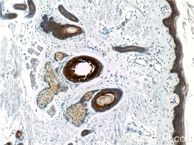 Cytokeratin 16 Antibody in Immunohistochemistry (Paraffin) (IHC (P))