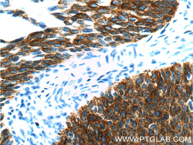 Cytokeratin 16 Antibody in Immunohistochemistry (Paraffin) (IHC (P))