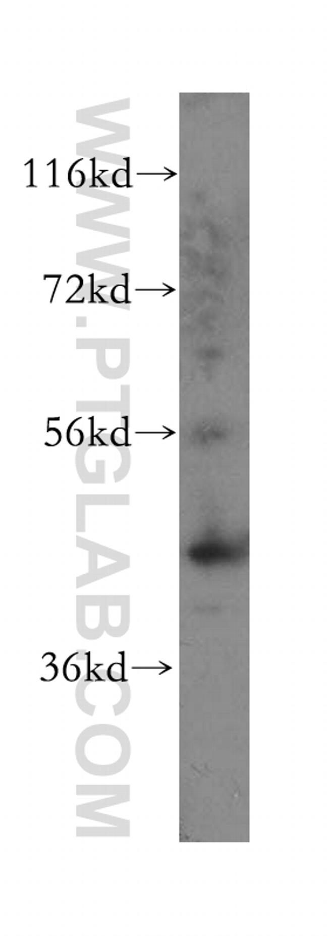 Cytokeratin 16 Antibody in Western Blot (WB)