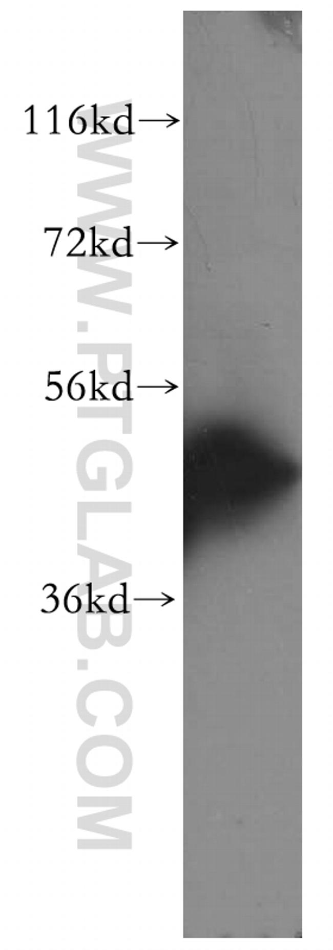 Cytokeratin 16 Antibody in Western Blot (WB)