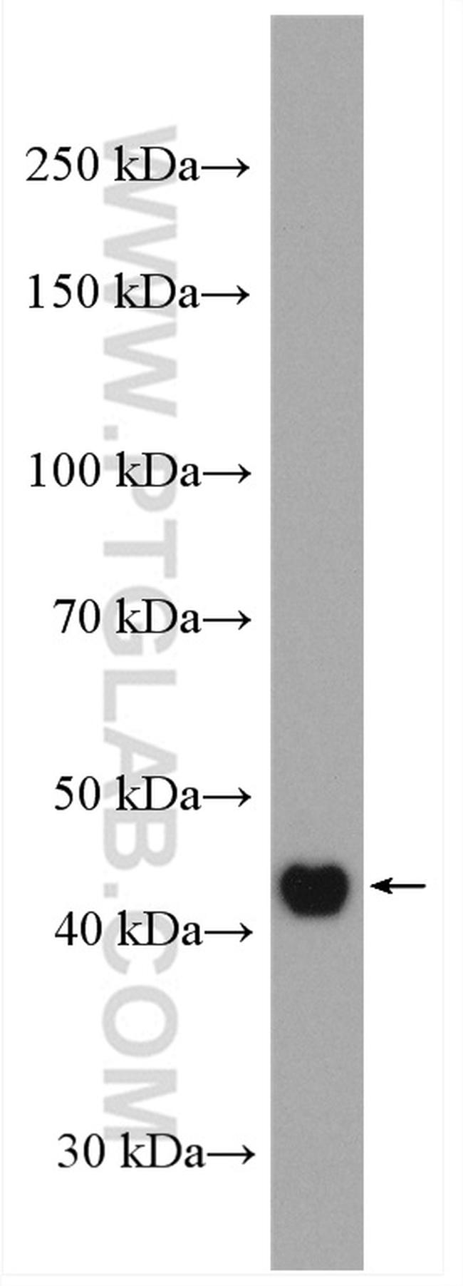 Cytokeratin 16 Antibody in Western Blot (WB)