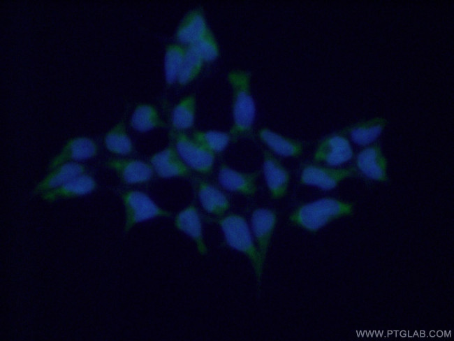 GSTA4 Antibody in Immunocytochemistry (ICC/IF)