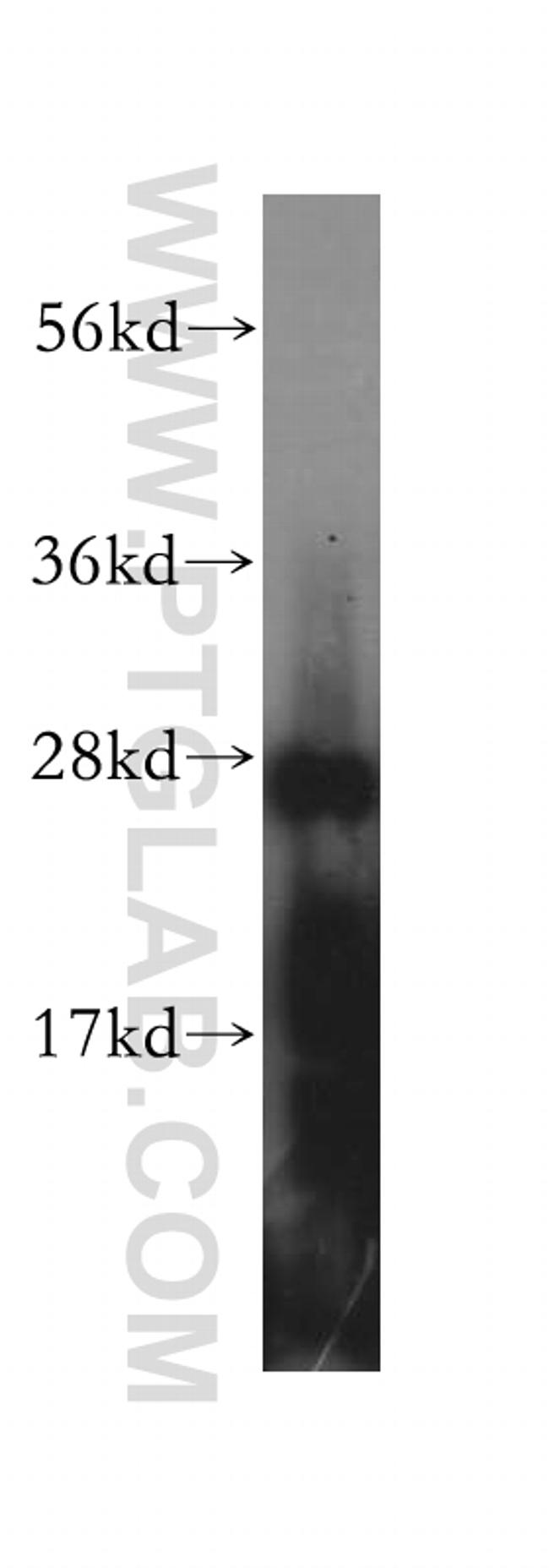 GSTA4 Antibody in Western Blot (WB)