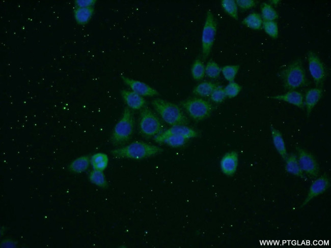 SNAPC5 Antibody in Immunocytochemistry (ICC/IF)